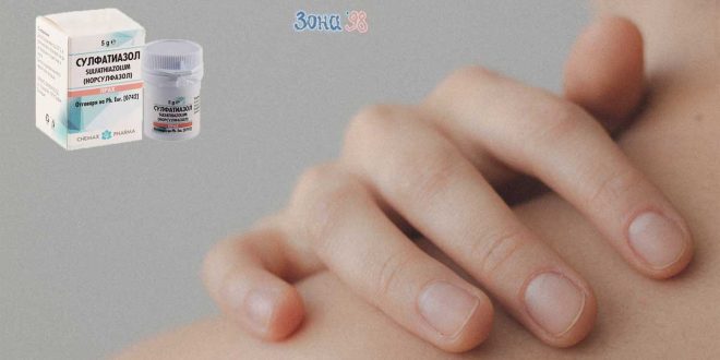 Пудра Сулфатиазол. Нещо за бързо зарастване на рани и при акне. Антибиотик ли е? Видове антибиотичен прах за рани. Сулфатиацол маз. Мнения и приложение.