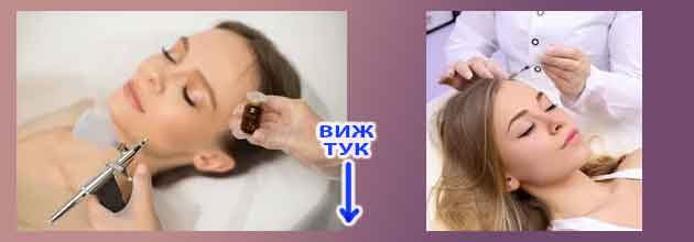 Странични ефекти от мезотерапия. Мнения. За лице и коса 3 Stranichni Efekti Ot Mezoterapia Mesotherapy 02