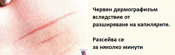Странични ефекти от мезотерапия. Мнения. За лице и коса 4 Мезотерапия странични ефекти 01
