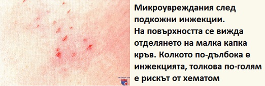 Странични ефекти от мезотерапия. Мнения. За лице и коса 5 Мезотерапия странични ефекти 02