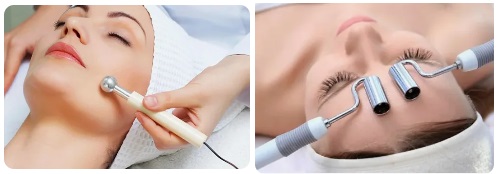 Йонофореза 01