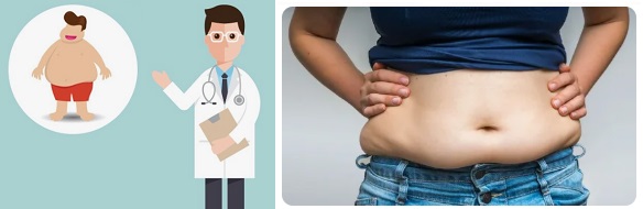 Глюкофаж отслабване Фигурин 02